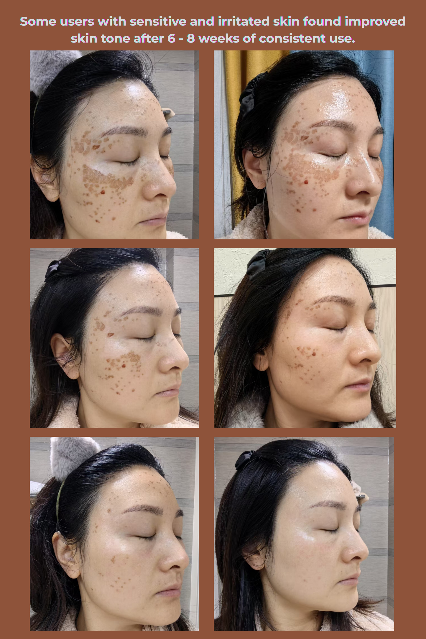 ThreeD Led Light Therapy Mask
