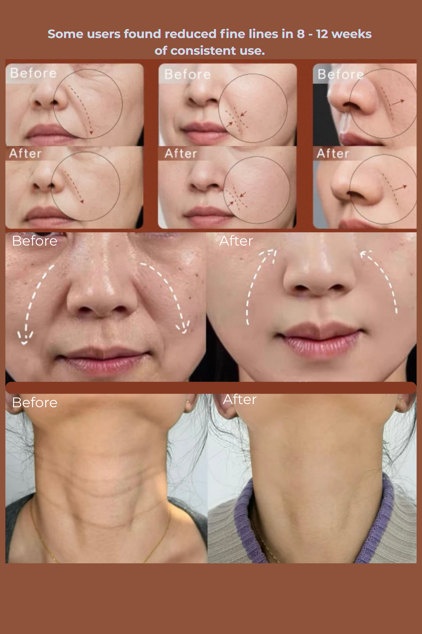 ThreeD Led Light Therapy Mask